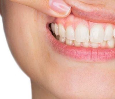 periodoncia